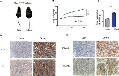 miR-6869-5p Transported by Plasma Extracellular Vesicles Mediates Renal Tubule Injury and Renin-Angiotensin System Activation in Obesity